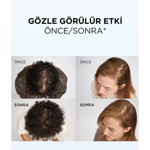 Elseve Growth Booster Dökülme Karşıtı Saç Bakım Kremi 150 ml - 4