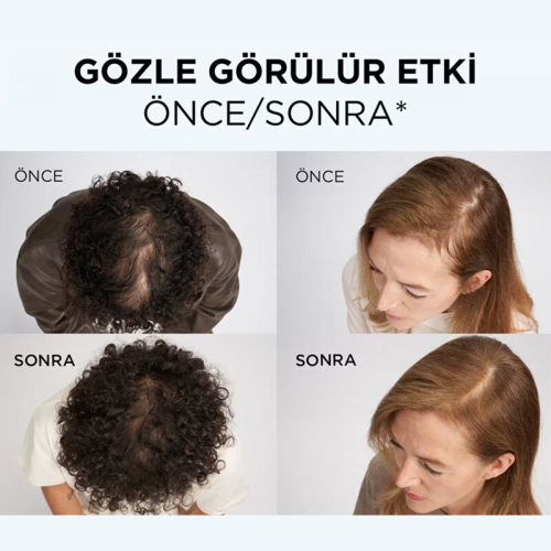 Elseve Growth Booster Saç Derisi Serumu 102 ml - 4