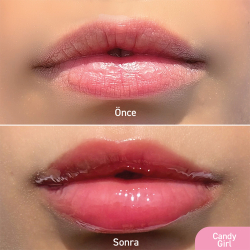 Herbaderm Lip Shine Balm - Candy Girl 10 ml - 3