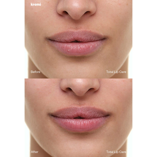 Kremi Total Lip Care 8 ml - 4