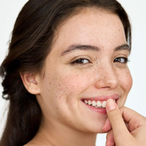 She Vec Rice Rice Baby – Aydınlatıcı Pirinç Tonik 200 ml - She Vec